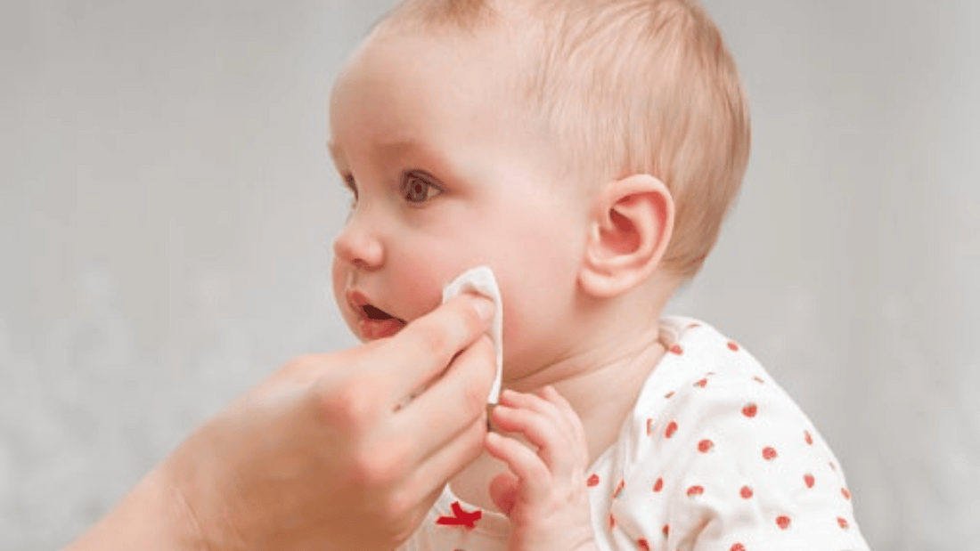 Treating Baby Acne with Breast Milk